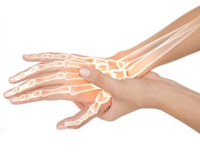 Hondrox tiek uzklāts skartajai zonai