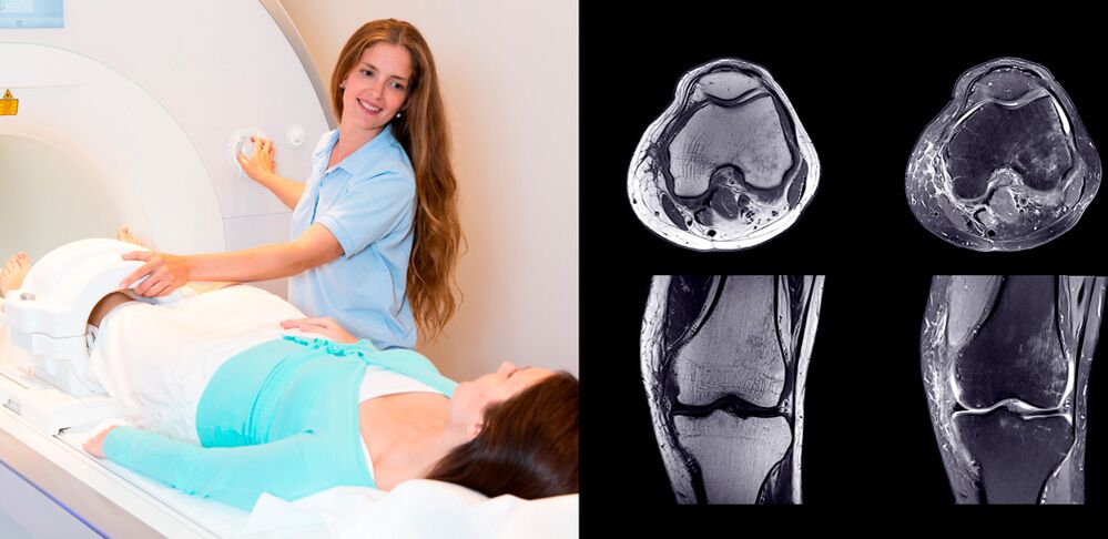 ceļa locītavas diagnostika