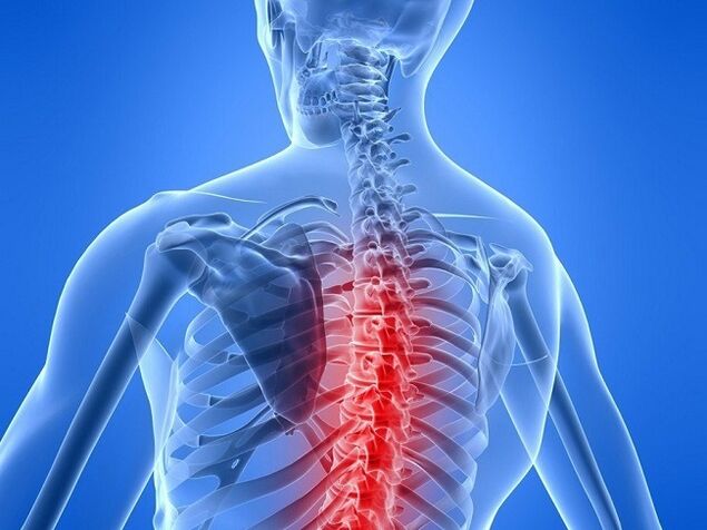 mugurkaula krūšu osteohondroze