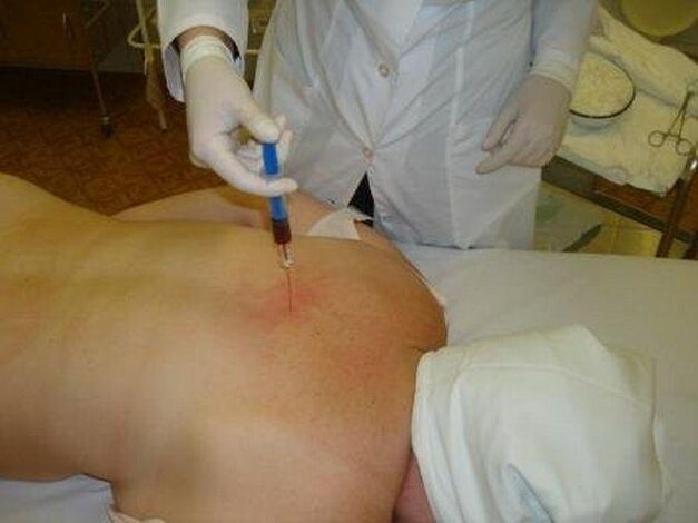 zāles osteohondrozes ārstēšanai