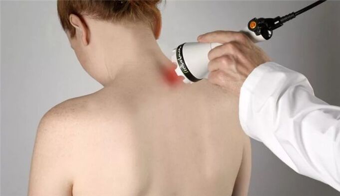 fizioterapija dzemdes kakla osteohondrozes ārstēšanai
