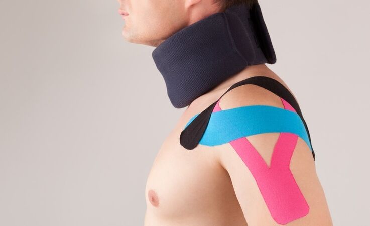 Dzemdes kakla osteohondrozes akūtā periodā ir jāvalkā īpaša apkakle